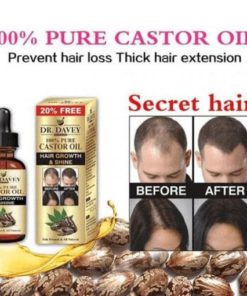 Oriental Oils Hair Nutrition / Hair Loss Treatment Solution