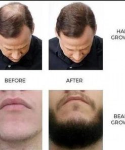 Alternative view of Oriental Oils Hair Nutrition / Hair Loss Treatment Solution