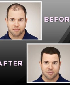 Alternative view of Natural Hair Thickener Powder