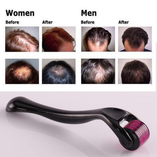 MicroNeedle Hair Growth Roller Buy Online 75 Off Wizzgoo Store