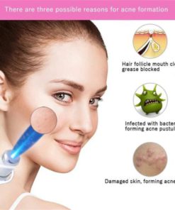 Alternative view of MediFwd Blue Light Therapy Varicose Veins Pen