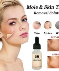 Mole Removal Serum