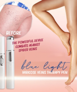 Blue Light Therapy Varicose Veins Pen