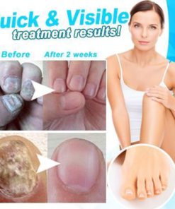 Alternative view of Anti-fungal Home Treatment Set