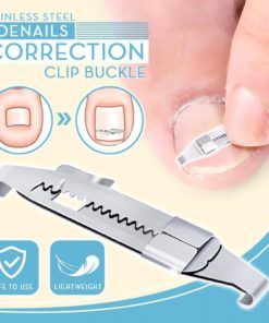 Toenails Correction Stainless Steel Clip Buckle