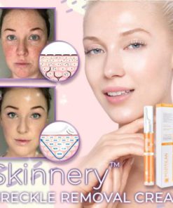 Skinnery Freckle Removal Cream