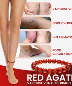 Red Agate Varicoses Relief Anklet