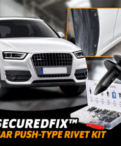 SecuredFix Car Push-Type Rivet Kit
