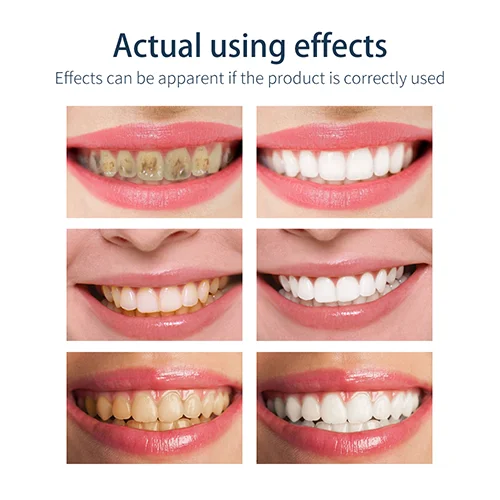Mousse Foam Whitening Toothpaste🔥BUY 1 GET 1 FREE🔥 - Image 3