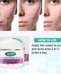 Alternative view of 🔥BUY 2 GET 1 FREE🔥Scarless Skin Rebound Cream