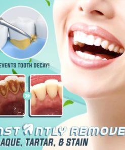 Alternative view of Ultrasonic LED Tooth Cleaner