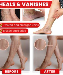 Alternative view of Red Agate Varicoses Relief Anklet