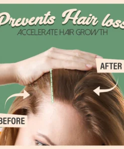 3-in-1 Ginger Darken+Anti Hair Loss Shampoo (4pcs)