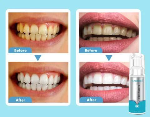 Brightify Deep Cleaning Foam Toothpaste - Image 7