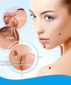 Alternative view of Instant Blemish Removal Gel（Limited time discount 🔥 last day）