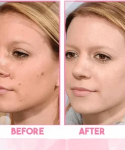 Alternative view of ReFine Skin Spot Purifying Essence