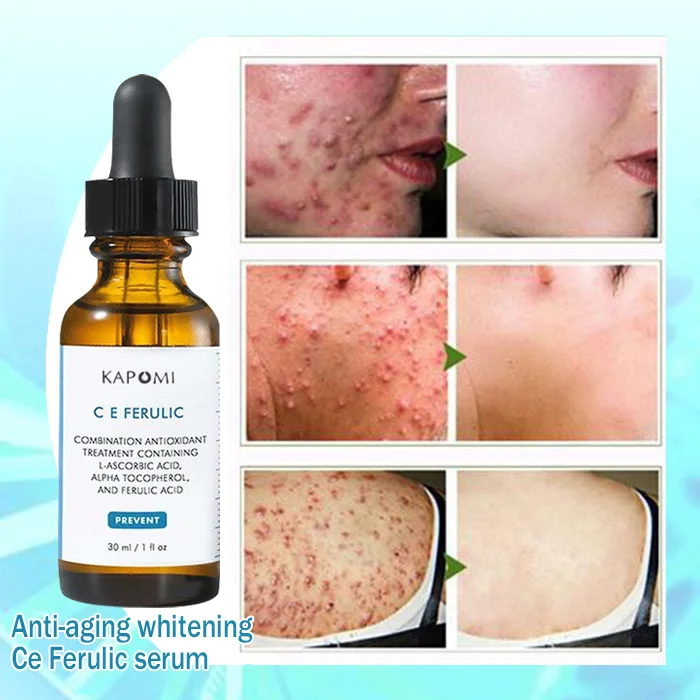Buy 1 Get 1 FreešKAPOMI CE2021 New Anti-aging Whitening Ce Ferulic Serum - Image 3