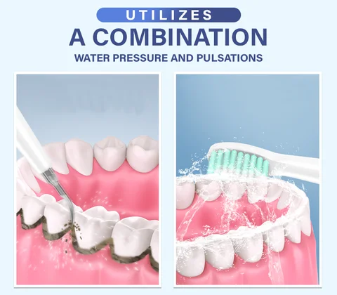 Electric Toothbrush Dental Calculus Remover Kit - Image 5