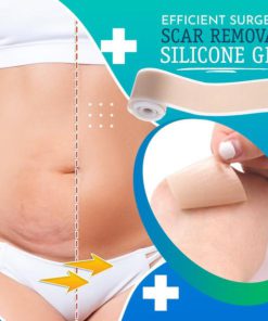 Alternative view of Silicone Scar Removal Sheets