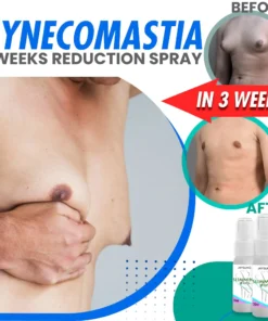 Gynecomastia 3 Weeks Cellulite Reduction Spray