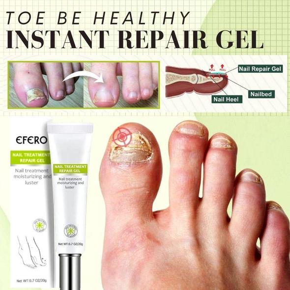 Toe Repair Instant Beauty Gel