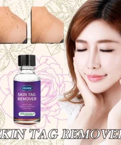 Alternative view of [SUMMER HOT SALE] Instant Freckle Removing Essence