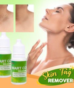 Skin Tag Remover