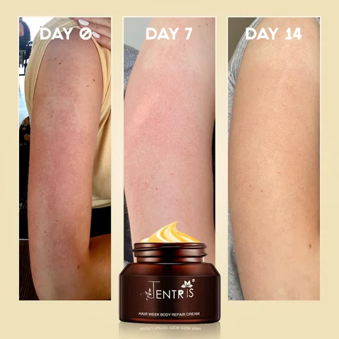 Keratosis Pilaris Repair Cream - Image 5