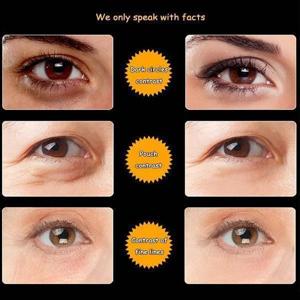 2021 Magic Electric Massager Eye Cream - Image 4