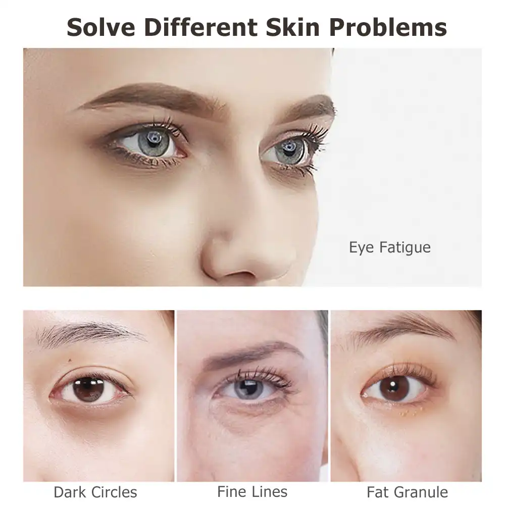 2021 Magic Electric Massager Eye Cream - Image 8