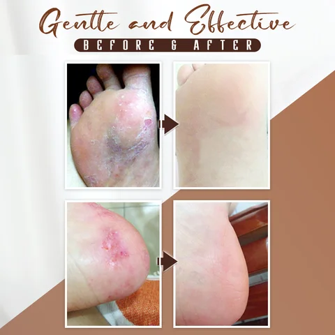 Natural Horse Oil Foot Repair Cream - Image 4