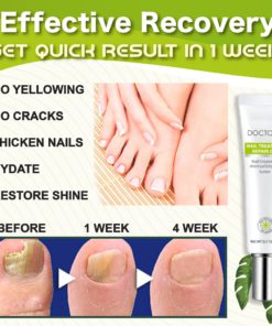 Alternative view of Health Toe Instant Beauty Gel