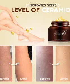 Alternative view of Keratosis Pilaris Repair Cream