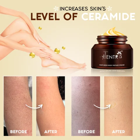 Keratosis Pilaris Repair Cream - Image 2