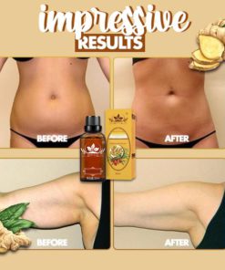 Alternative view of Essential Organic Lymphatic Drainage Ginger Oil