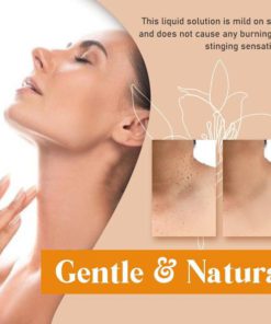 Alternative view of Skin Tag Remover