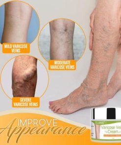 Alternative view of Organic Healing Cream for Varicose Vein