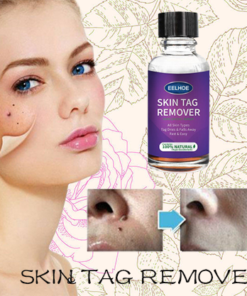 [SUMMER HOT SALE] Instant Freckle Removing Essence