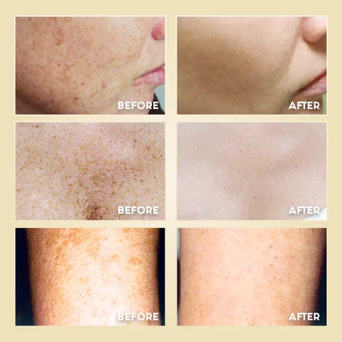 Keratosis Pilaris Repair Cream - Image 4