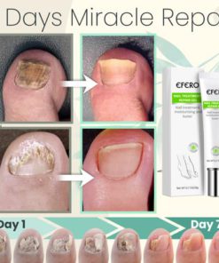 Alternative view of Toe Be Health 7 Days Treatment Gel