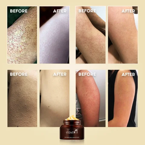 Keratosis Pilaris Repair Cream - Image 3
