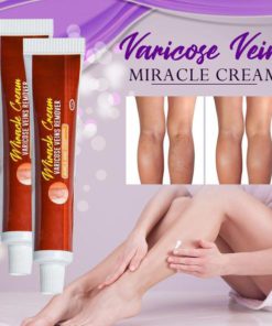 New Varicose Veins Miracle Cream