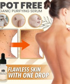 SpotOut Organic Purifying Serum