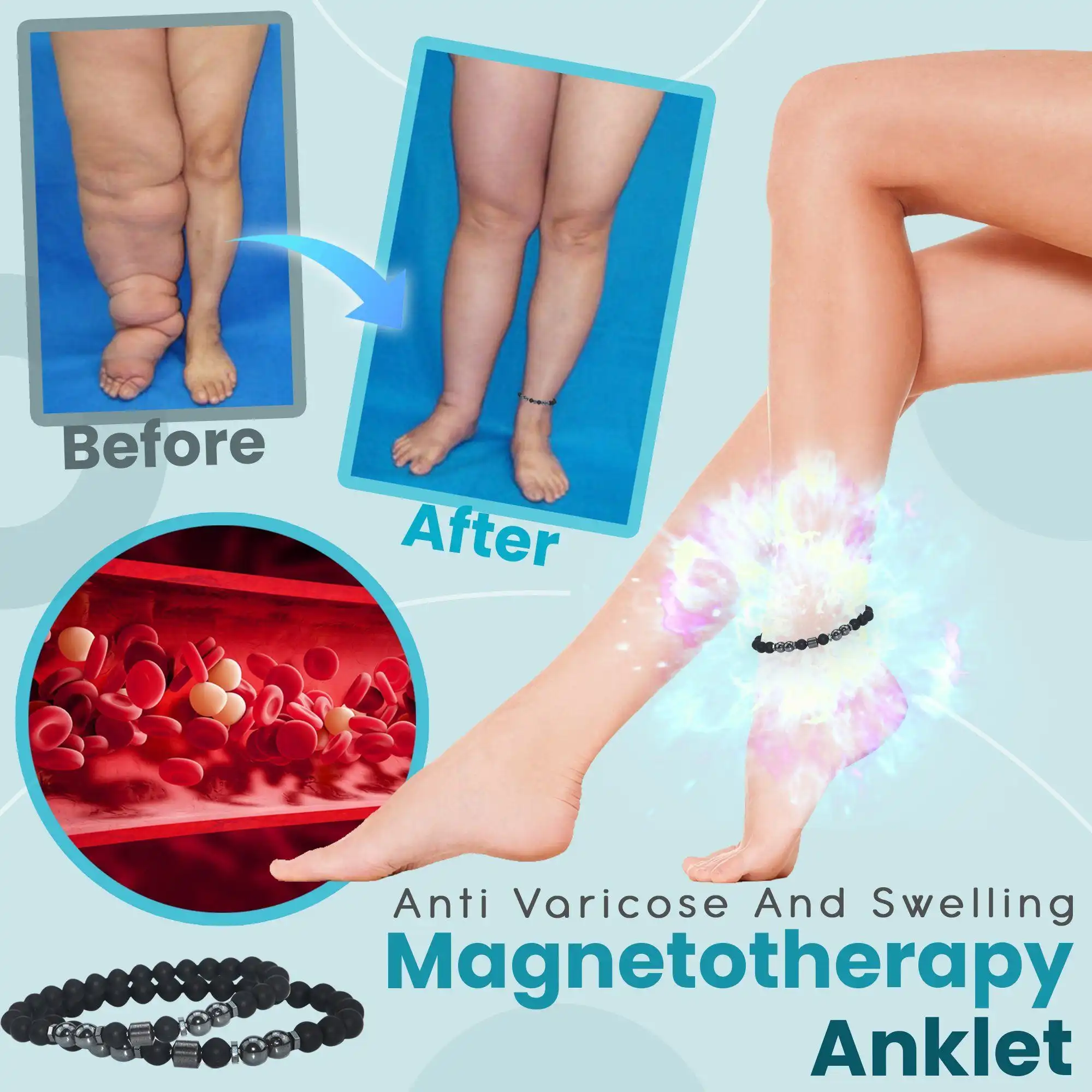 Anti Varicose And Swelling Magnetotherapy Anklet
