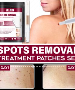 Spots Removal Treatment Patches Set
