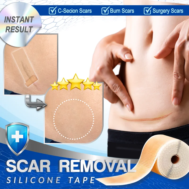 Professional Scar Removal Silicone Tape