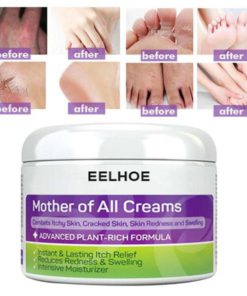 Anti Fungal Skin Rash Crema