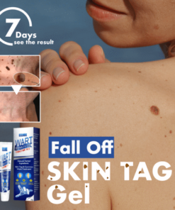 Fall Off Skin Tag Gel