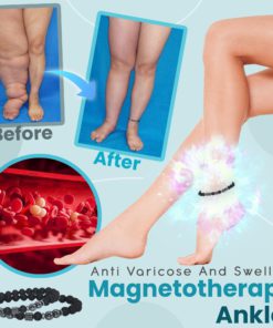 Anti Varicose And Swelling Magnetotherapy Anklet