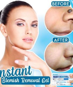 WartsOff Instant Blemish Removal Cream